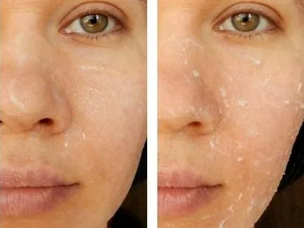 Exfoliantă rola de la marca de față și de acasă căi de atac în stratul de acoperire, utilizarea (o persoană) Exfoliantă rola de la marca a feței și de acasă căi de atac în stratul de acoperire Utilizare