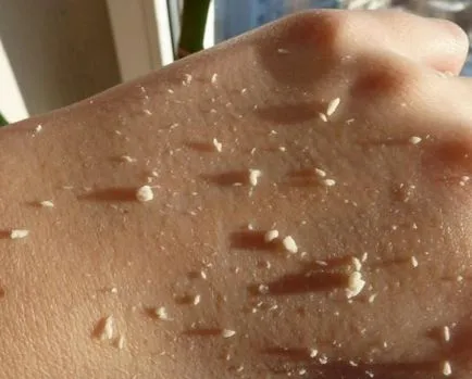 Exfoliantă rola de la paltonul pentru a face față în mod eficient curăță pielea