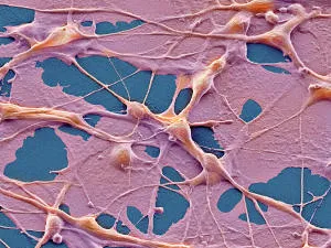Cancer la simptome si tratament pisici (simptome) Cancer la simptome pisici si tratament