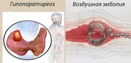 Realizarea rezecția subtotală a glandei tiroide