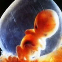Amplasarea fătului în uter imagini, prezentare fetale (prezentare) Amplasarea fătului în imagini uter, prezentare fetale
