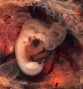 Amplasarea fătului in utero de saptamana de sarcina
