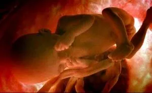 Amplasarea fătului in utero de saptamana de sarcina