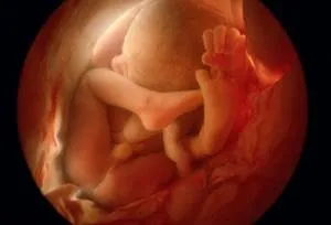 Amplasarea fătului in utero de saptamana de sarcina
