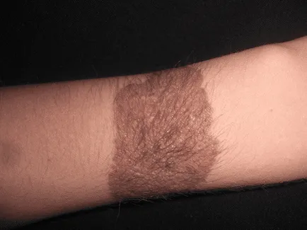 Nevilor valoarea lor (corpul birthmark pe partea din spate a fesei mână valoarea lui coapsa gât picior) Locul de amplasare și aspectul Valoarea birthmarks a locației și aspectul lor