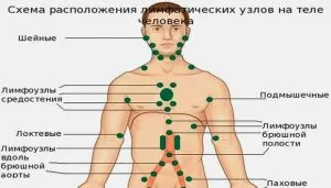 Simptome, diagnostic și tratament al tuberculozei nodulilor limfatici