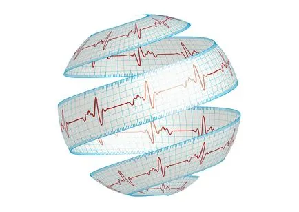 Sindromul de repolarizării ventriculare precoce