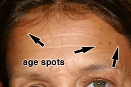 Aging tânăr - Lecții Photoshop