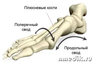 Gradul și tipul de flatfoot, tratamentul și prevenirea