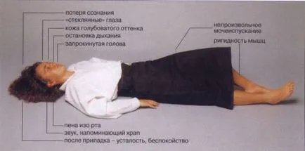 Cauze de crampe la nivelul picioarelor pe timp de noapte (de ce reduce vițeilor), tratament (motive) Cauzele crampe la nivelul picioarelor pe timp de noapte (de ce reduce vițeilor), tratamentul
