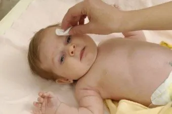 Un nou-născut de îngrijire a pielii solzoase, tratament, acțiune (firimituri coaja de pe piele) Un nou-născut solzoase de îngrijire a pielii, tratament, acțiune
