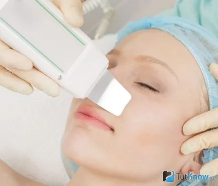 Cu ultrasunete tehnica peeling beneficii feței, rezultatul