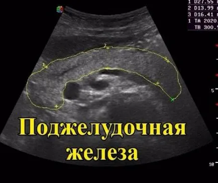 Uzi preparare pancreasului, decodificare, norme