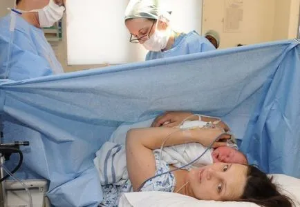 Cotul uterului și sarcinii șansele de concepție, metode de tratament (cot) îndoire a uterului si sarcina șansele de a concepe, tratamente