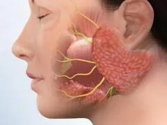 Face de porc boala, simptome și tratament, măsurile preventive sunt contagioase (Gilt) Fie că boala de porc contagioase, simptome și tratament, măsuri preventive