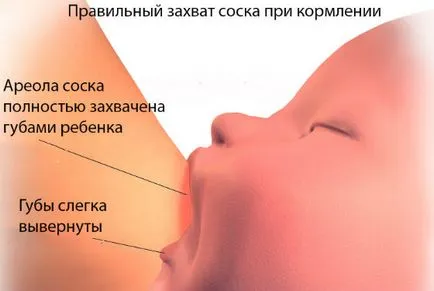 Stagnarea de lapte la mamele care alăptează cauzele care fac, tratamentul și prevenirea lactostasis, folk (lactostasis) Stagnarea de lapte la mamele care alăptează cauzele care fac, tratamentul și prevenirea lactostasis, folk