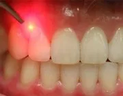 7 dovedit moduri de a scăpa de cariilor dentare