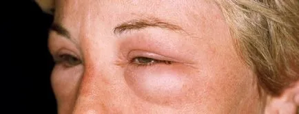 Alergia să se confrunte cu cauze crem, simptome, tratament