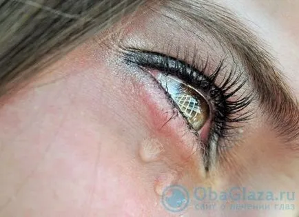 9 moduri de eliminare lacrimi edem ocular după (minute) 9 moduri de modul de a elimina ochii umflarea cu lacrimi după