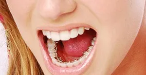 Bretele, clinica moderna stomatologie „garant“