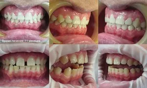Bretele, clinica moderna stomatologie „garant“