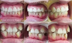 Bretele, clinica moderna stomatologie „garant“