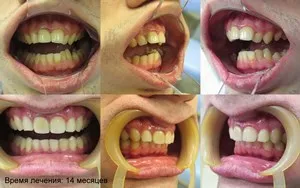 Bretele, clinica moderna stomatologie „garant“