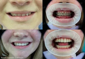 Bretele, clinica moderna stomatologie „garant“