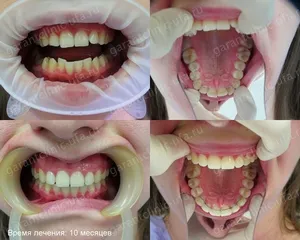 Bretele, clinica moderna stomatologie „garant“
