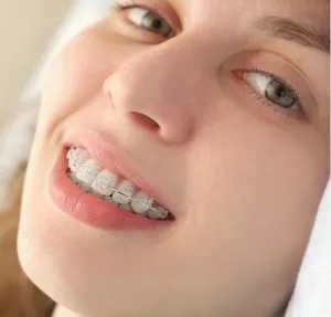 acolade dentare