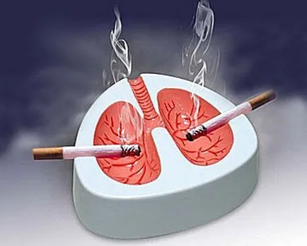 Simptome bronșitei și tratament fumător (bronșită cronică fumătorului) simptome bronsita fumătorului si tratament
