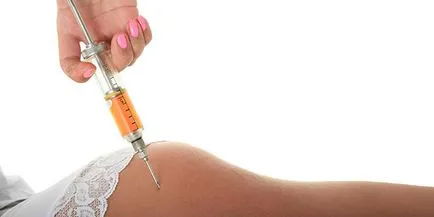 Ce se întâmplă dacă după injecții efecte inflamat injecții fesieri (inflamat) Ce se întâmplă dacă după o durere în fesa efecte injecții fotografii