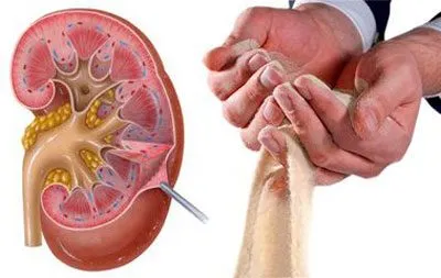 Ce este un echipament de medicație terapie de detoxifiere (terapie) Ce este preparatele de terapie de detoxifiere,