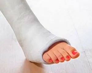 Diagnosticul și tratamentul fracturilor în timpul sarcinii (sarcina) Diagnosticul și tratamentul fracturilor în timpul sarcinii