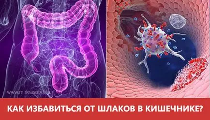 Păstrați intestine curat! 12 metode de purificare a zgurei acumulate (purificare) Păstrați intestine curat! 12 metode de purificare a zgurii acumulate