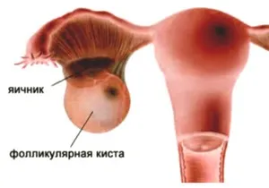 Follikulometriya atunci când se planifică pregătirea sarcinii, comportament, evaluare,
