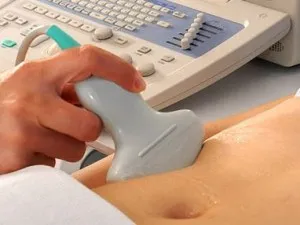 Foliculilor în ovare la menopauza principalele motive pentru modificările