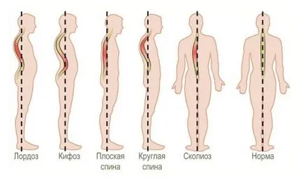 lordozei fiziologice