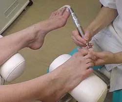 Hiperkeratoza - cauze, simptome, diagnostic și tratament