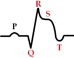 simptome de atac de cord si tratament