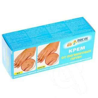 Cum sa scapi de pigmentare pe fata folosind crema (pigmentare) Cum sa scapi de pigmentare pe fata folosind crema