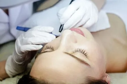 Cum sa scapi de antenele de pe buza superioară la domiciliu, la cosmeticiana, rețete populare, ladybe (buze) Cum sa scapi de antenele de pe buza superioară la domiciliu, la cosmeticiana, rețete populare, ladybe