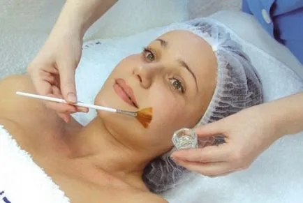 Cum sa scapi de cicatrici pe fata - de rectificat, coji, de eliminare cu laser, remedii populare