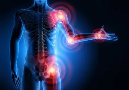 Cum de a vindeca boala metodelor osteoartritei primare moderne de tratament și de prevenire (metode) Cum de a vindeca boala metodelor osteoartritei primare moderne de tratament și de prevenire