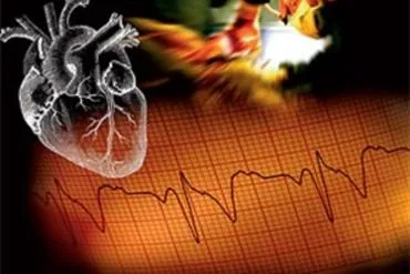 sanatoriu cardiologică în 2017 prețurile cu tratament, site-ul oficial al expertului stațiune