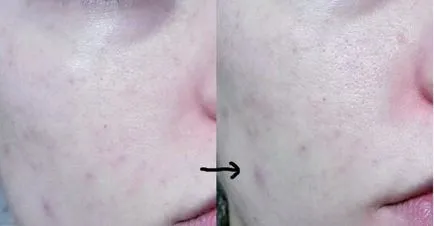 Gigi cosmetice comentarii care spun esteticieni (Gigi) (a spune) Gigi cosmetice comentarii care spun esteticieni (Gigi)