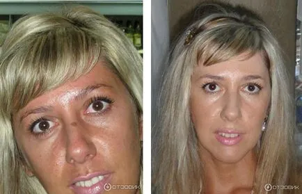 Creme de pete de pigment modul de selectare și de utilizare, populare și cele mai bune produse (pigment) Creme de pete de pigment cum să selecteze și să utilizeze, mai populare și cele mai bune mijloace