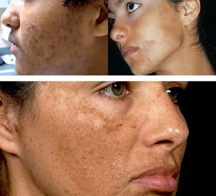 Creme de pete de pigment cum să selecteze și să utilizeze, populare și cele mai bune produse (cel mai bun) Creme de pete de pigment cum să selecteze și să utilizeze, mai populare și cele mai bune mijloace