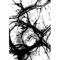 trunchiul pulmonar 1