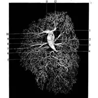 trunchiul pulmonar 1